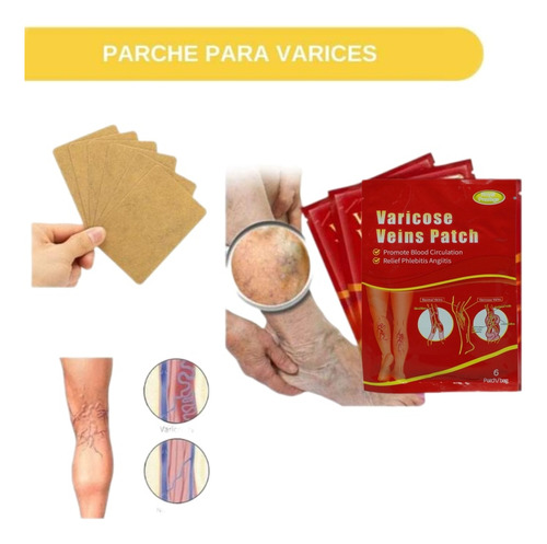 12 Parches Chinos Para Varices,venas Varicosas Arañitas 