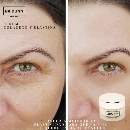 Crema Facial Rejuvenecedora Y Despigmentante Quita Manchas