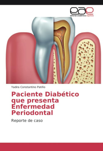 Libro: Paciente Diabético Que Presenta Enfermedad Periodonta