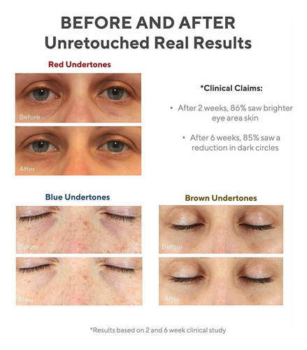 Murad Ambiental Shield Vita-c Ojos Corrector De CĂrculo Oscu