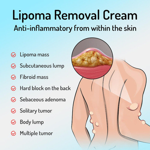 Crema Limpiadora Block Care Products Lipoma Nursing Cream