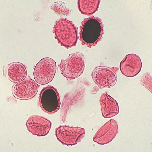 Primeira imagem para pesquisa de laminas preparadas parasitologia