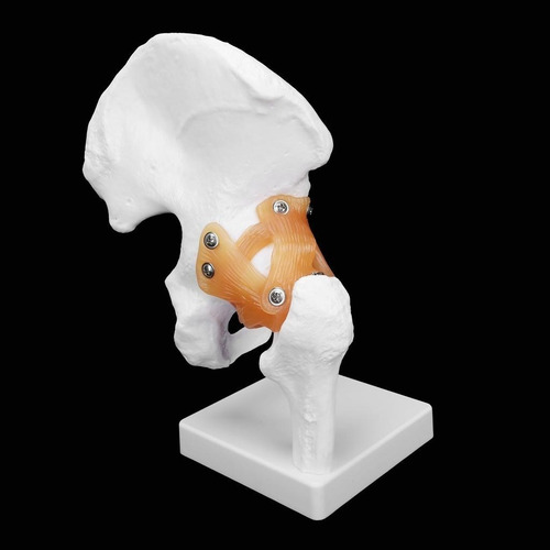 Imagen 3 de 7 de Modelo Articulación De Cadera