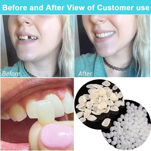 Kits De Reparación De Dientes Postizos Para Rellenar Los Die