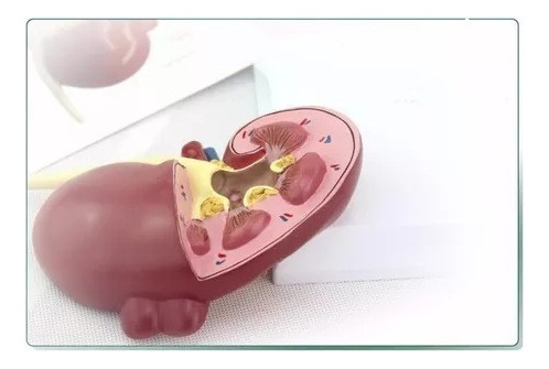 Modelo Anatômico P/ Estudo Rim Com Patologia