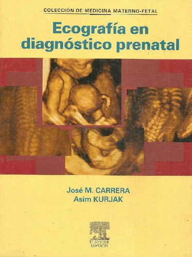 Libro Ecografia En Diagnostico Prenatal De Jose M Carrera As