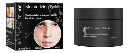 Ee Balsamo En Crema Humectante Limpiadora, Cara, Anti Acne Momento De Aplicación Día/noche Tipo De Piel Mixta