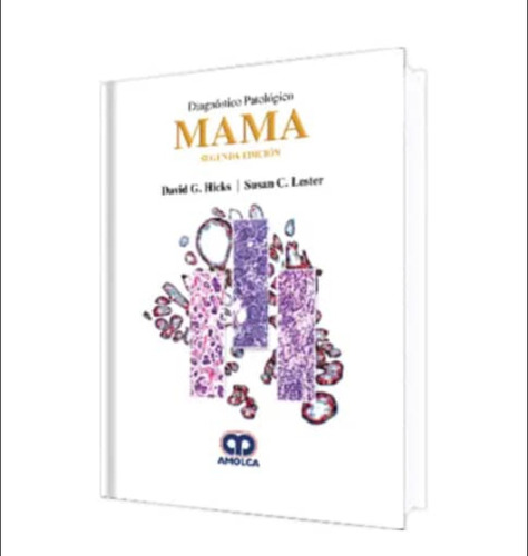 Diagnóstico Patológico Mama  2 Edición