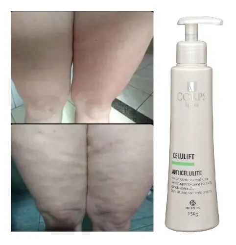 Crema Reductora Anticelulitis Corps Celulift 150g Hinode