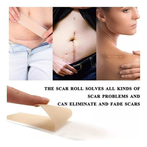 Faixa Fita De Gel Abdominoplastia Cicatriz Queloide