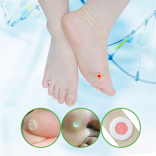 Q Corn Paste Removes Corns, Blisters, And Feet Corns Re 6254