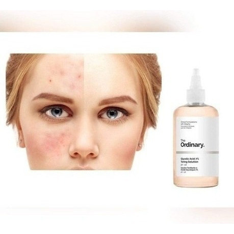 . The Ordinary Acido Glicolic 7% Acondicionador, 8,11 Onzas