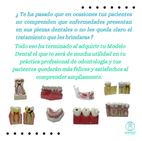 Modelo Dental Resina Y Amalgama