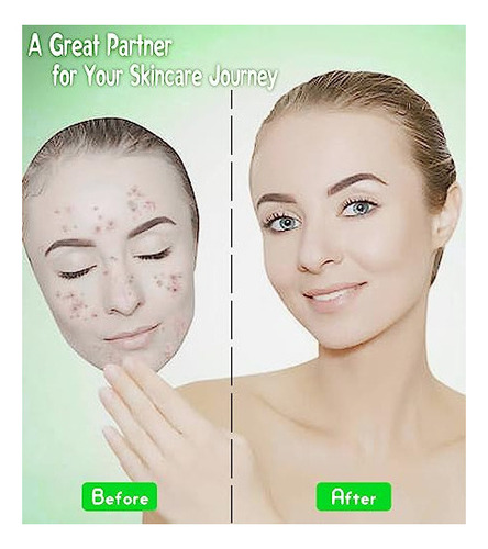 Fancyou Toalla Facial Desechable 500, Toallitas Espesas Para