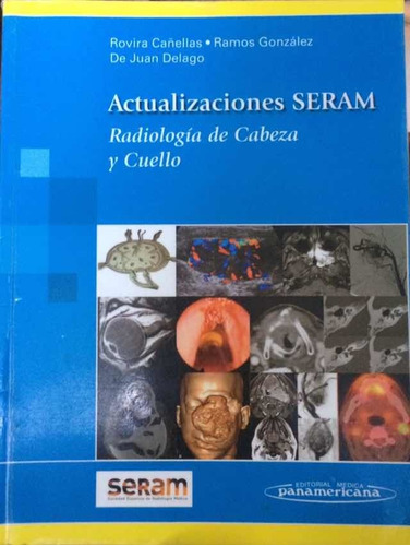 Radiología De Cabeza Y Cuello Actualizaciones Serán.