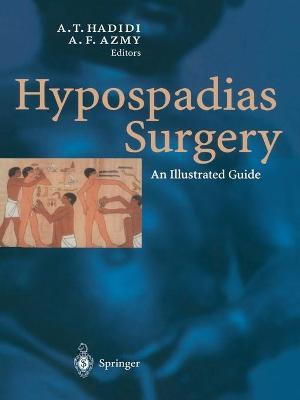 Libro Hypospadias Surgery : An Illustrated Guide - Ahmed ...