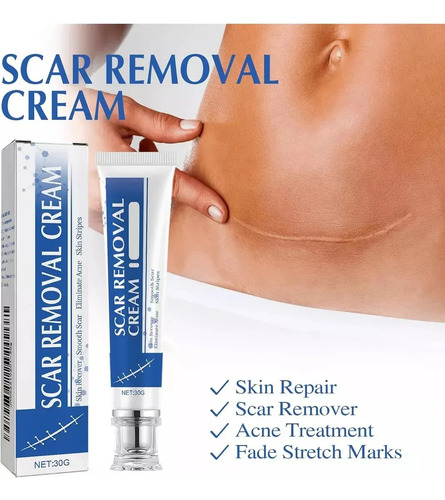Fb Crema De Silicona Para Eliminar Cicatrices Quirúrgicas