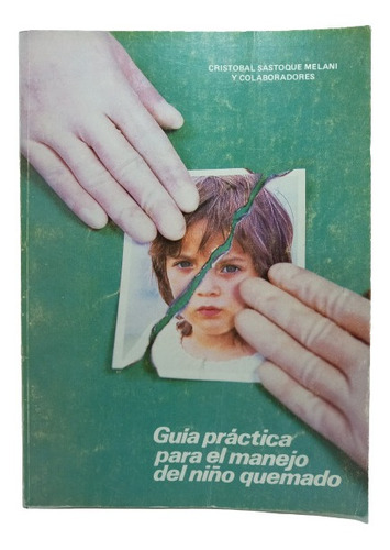 Guía Práctica Para El Manejo Del Niño Quemado - C Sastoque M