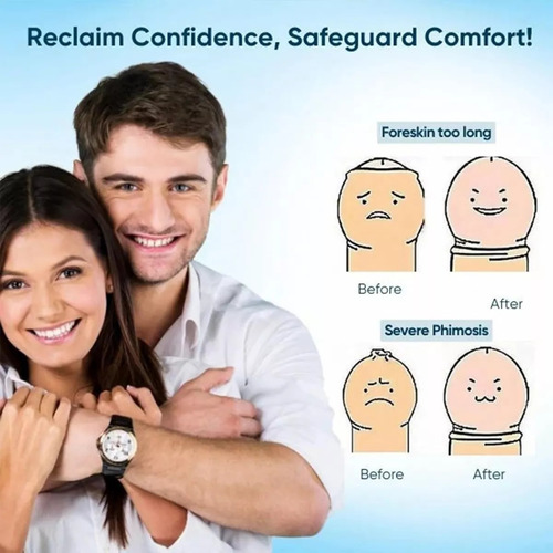 Gel Corrector De Prepucio Redundante, Acción Rápida Y Suave,