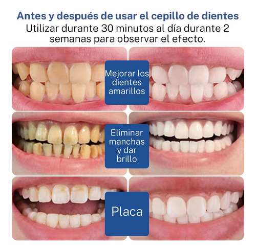 Kit De Blanquear Dientes Lampara Led Gel Dental 7 En 1