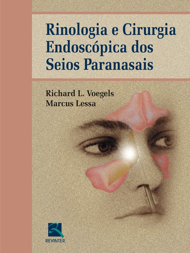 Rinologia e Cirurgia Endoscópica dos Seios Paranasais, de Voegels, Richard. Editora Thieme Revinter Publicações Ltda, capa dura em português, 2005