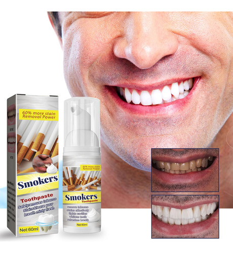 Pasta Dentífrica/gel Blanqueador Para Fumadores F Smokers 45