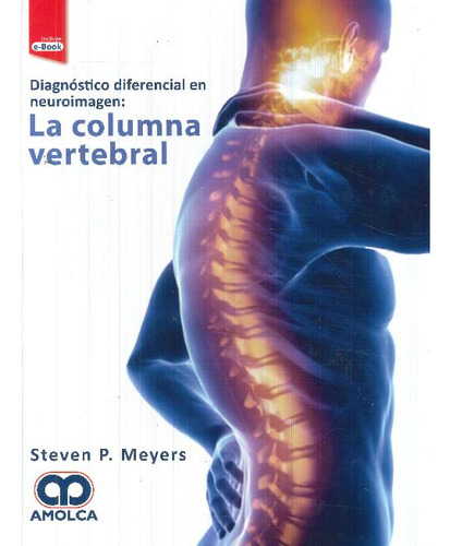 Libro Diagnóstico Diferencial En Neuroimagen: La Columna Ver