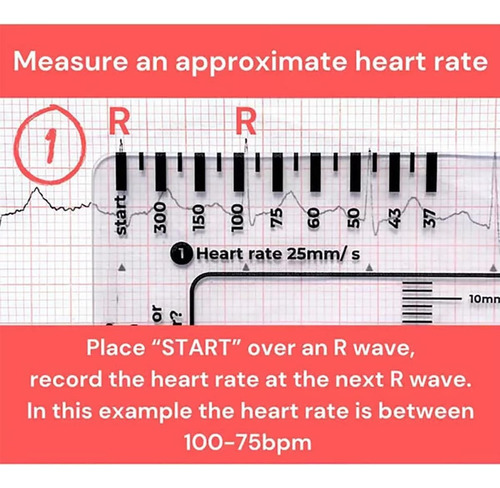 Regla De 7 Pasos Para Electrocardiogramas, Regla De Bolsillo