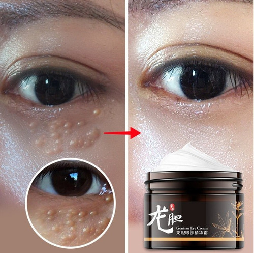 Crema Esencia Ojos Genciana For Eliminar Ojeras Ne