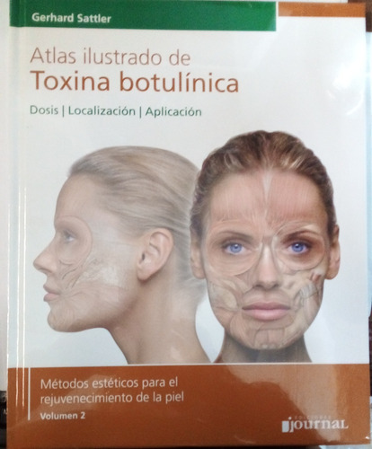 Atlas Ilustrado De Toxina Botulínica