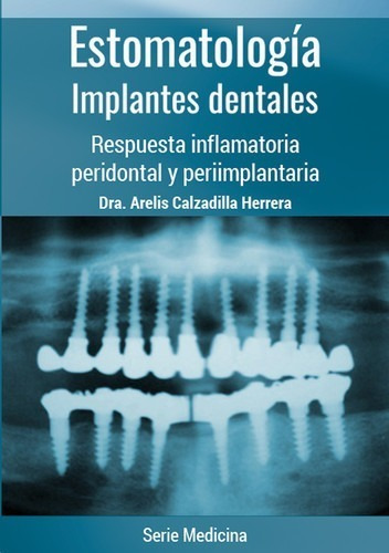 Libro Estomatología. Implantes Dentales - Dra. Arelis Calza