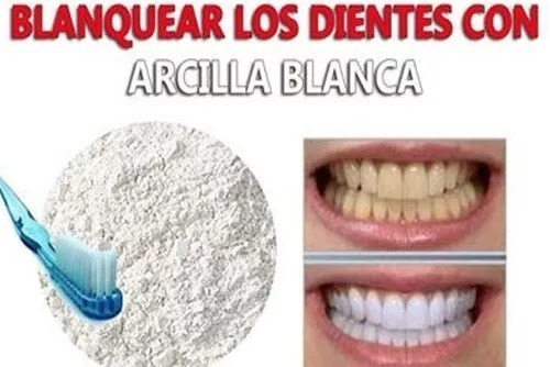 Arcilla Blanca