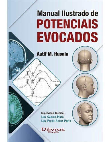 Manual Ilustrado De Potenciais Evocados - Husain, De Husain, Aatif. Editora Dilivros, Capa Dura, Edição 1 Em Português, 2021