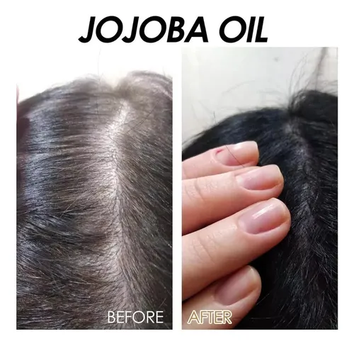 /aceite De Jojoba Orgánico, Prensado En Frío, Aceite Hidrata