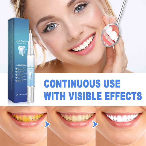 Bolígrafo Blanqueador Dental E Rotary Whitener Whitening T 4