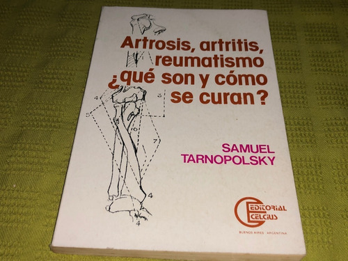 Artrosis, Artritis, Reumatismo Qué Son Y Cómo Se Curan?