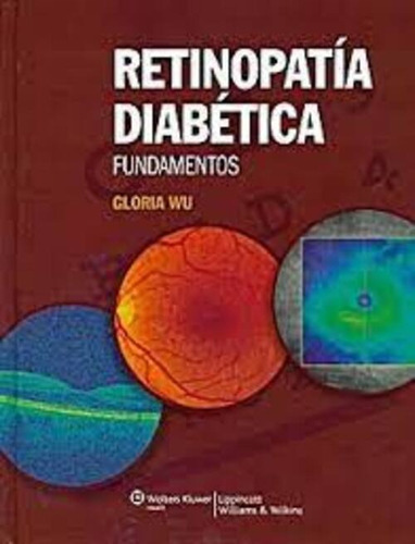 Retinopatia Diabetica - Wu, Gloria (papel) 
