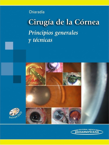 Cirugia De La Cornea - Chiaradia 