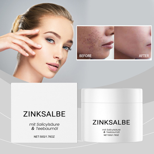 Ungüento De Zinc De 50 G Con Aceite De Árbol De Té Y Antisal