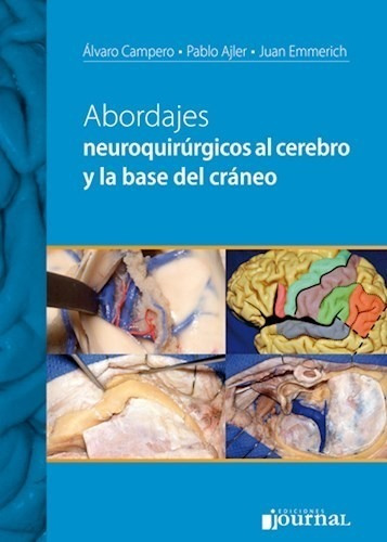 Abordajes Neuroquirúrgicos Al Cerebro Y Base Cráneo- Campero