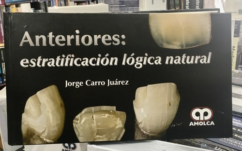 Anteriores Estratificación Lógica Natural, De Jorge Carro Juárez. Editorial Amolca En Español