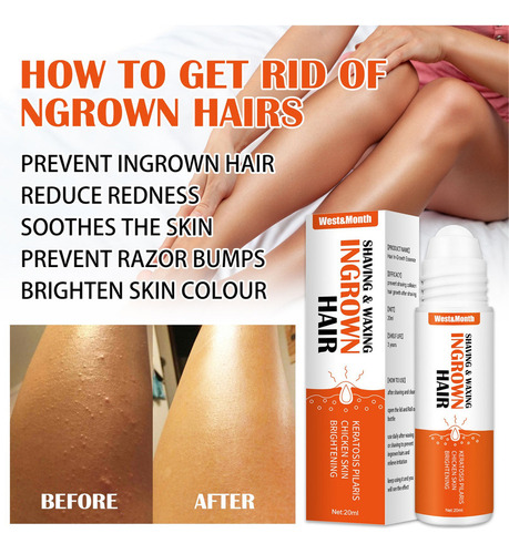 Creme Remoção 2×reduz Pelos Encravados E Manchas