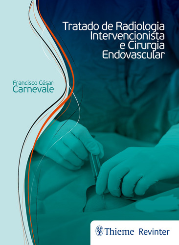 Tratado de Radiologia Intervencionista e Cirurgia Endovascular, de Carnevale, Francisco César. Editorial Thieme Revinter Publicações Ltda, capa dura em português, 2017