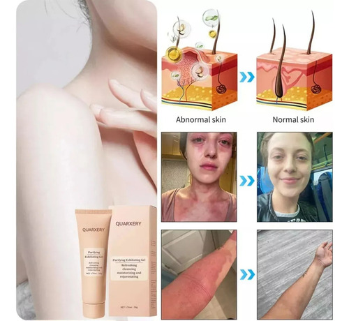 Gel Exfoliante Quarxer Gel Exfoliante Purificante Quarxery