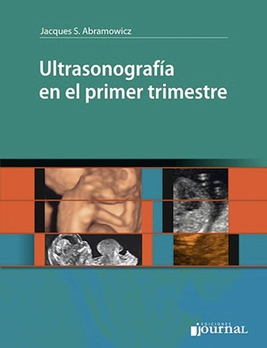 Ultrasonografía En El Primer Trimestre - Abramowicz