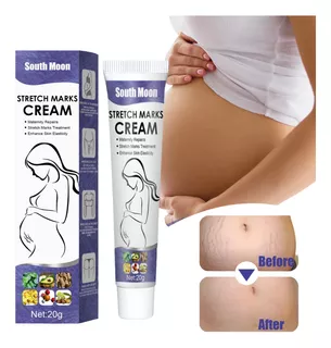 South Moon Stretch Mark Reparador Crema Para Estrías, Cicatr