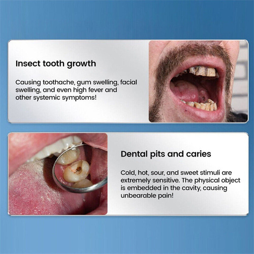 - Pasta De Dientes De Reparación Rápida For Caries 120 G*2