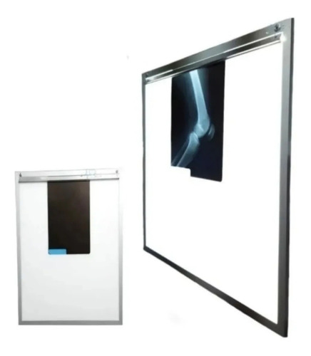 Imagen 9 de 9 de Negatoscopio Led Ultra Slim 60x60cm .7 Milimetros De Grueso