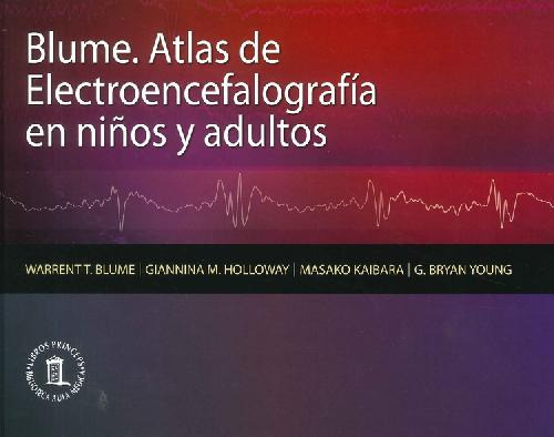 Libro Atlas De Electroencefalografía En Niños Y Adultos De W