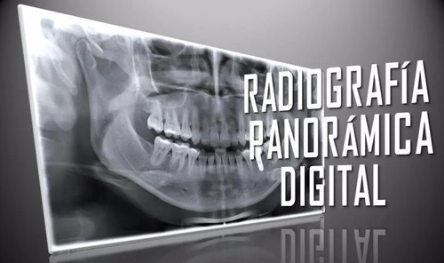 Imagen 2 de 6 de Radiografía Panorámica Dental